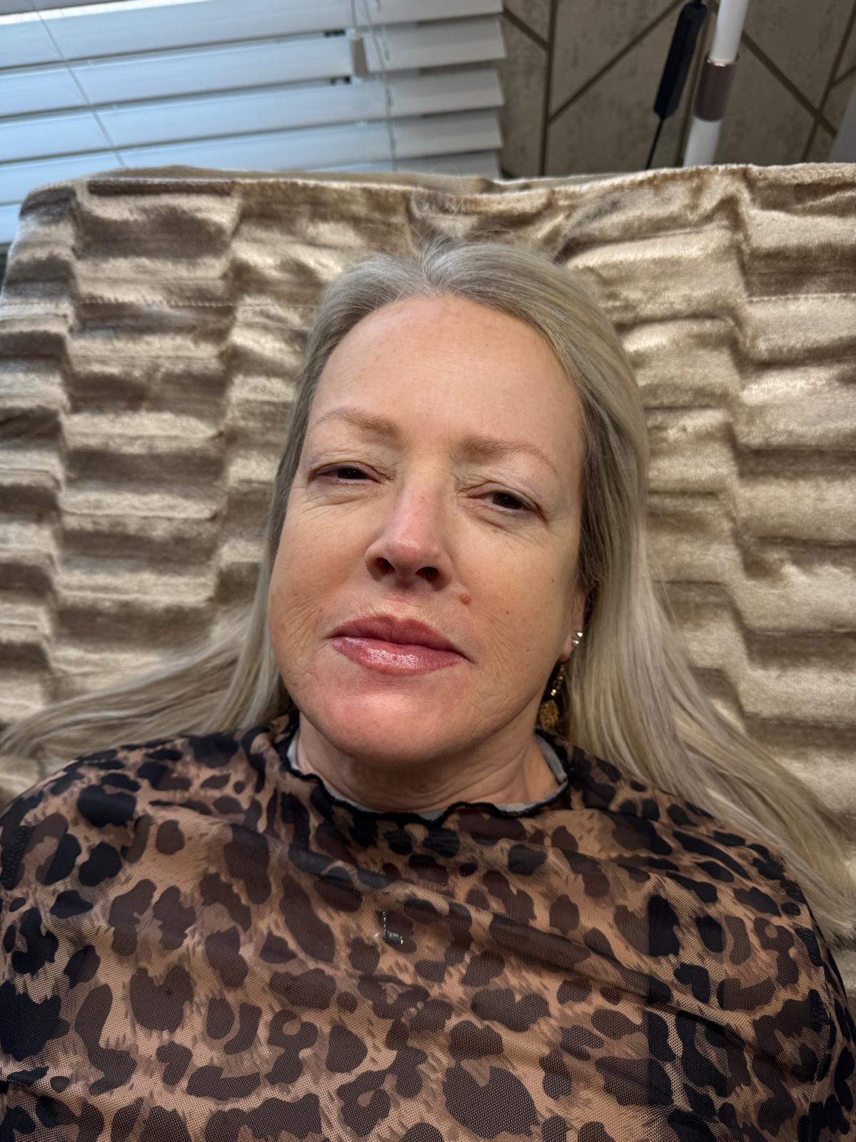Lip Blush — after