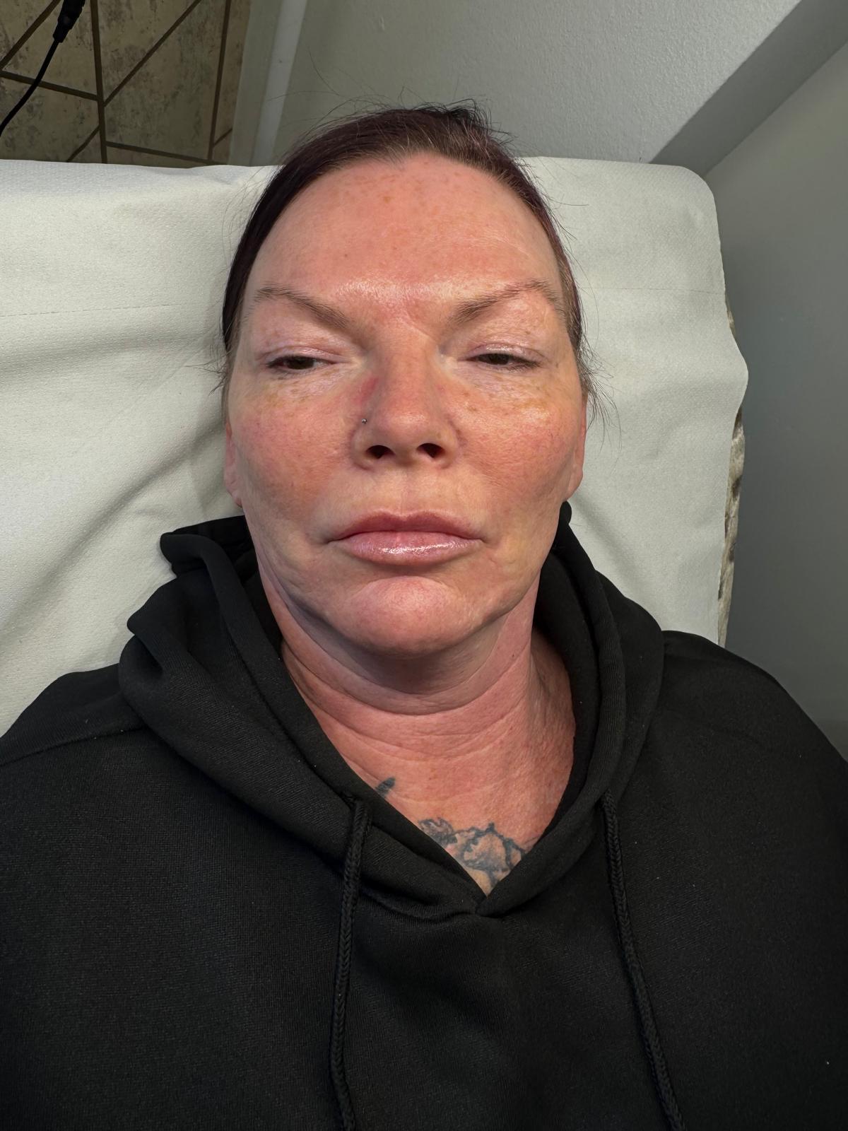 Powder Brows — before