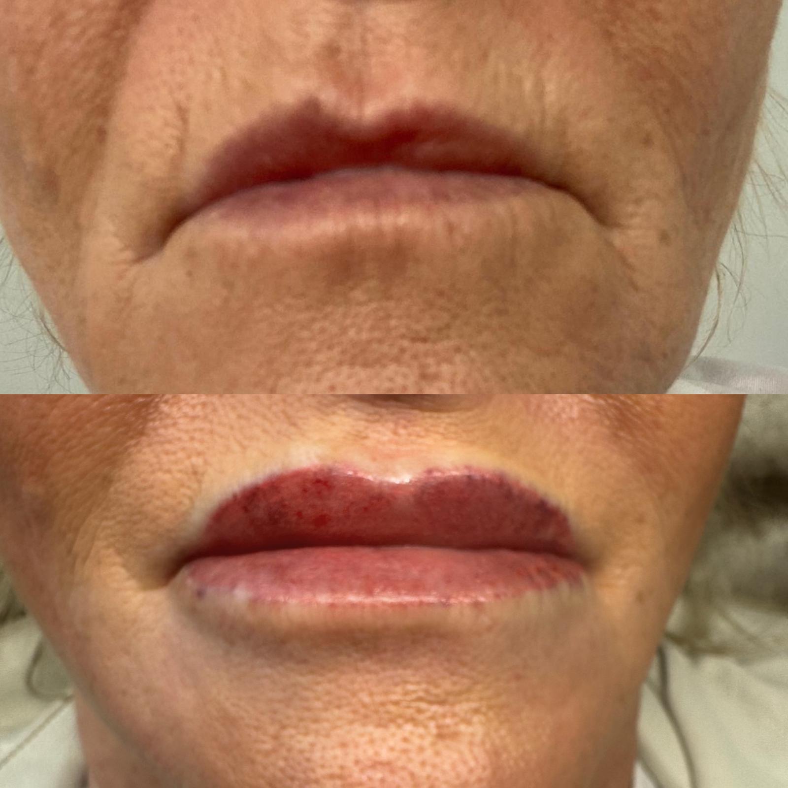 Lip Blush — before and after