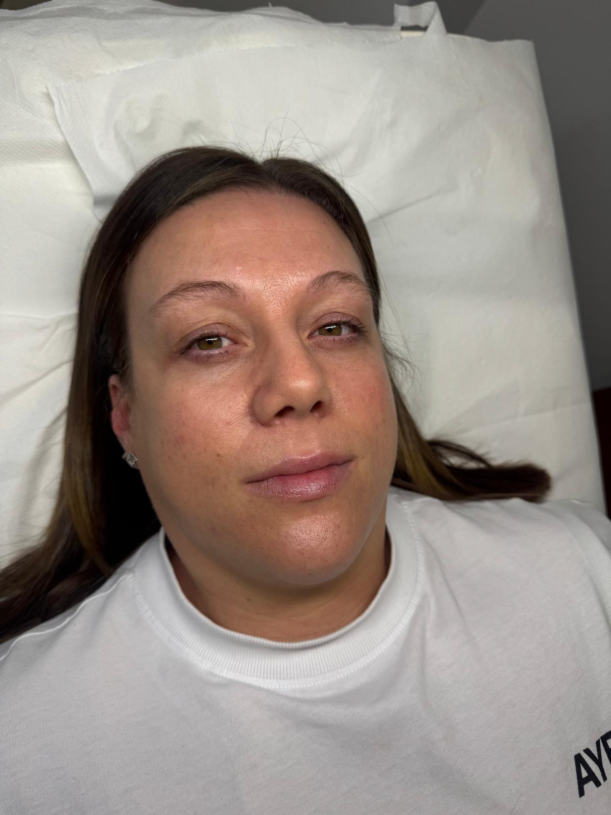 Powder Brows — before