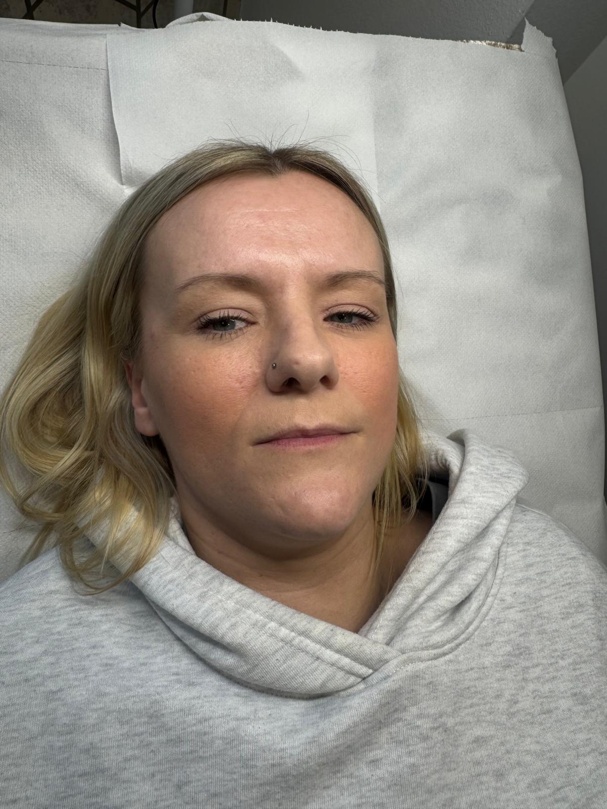 Powder Brows — before