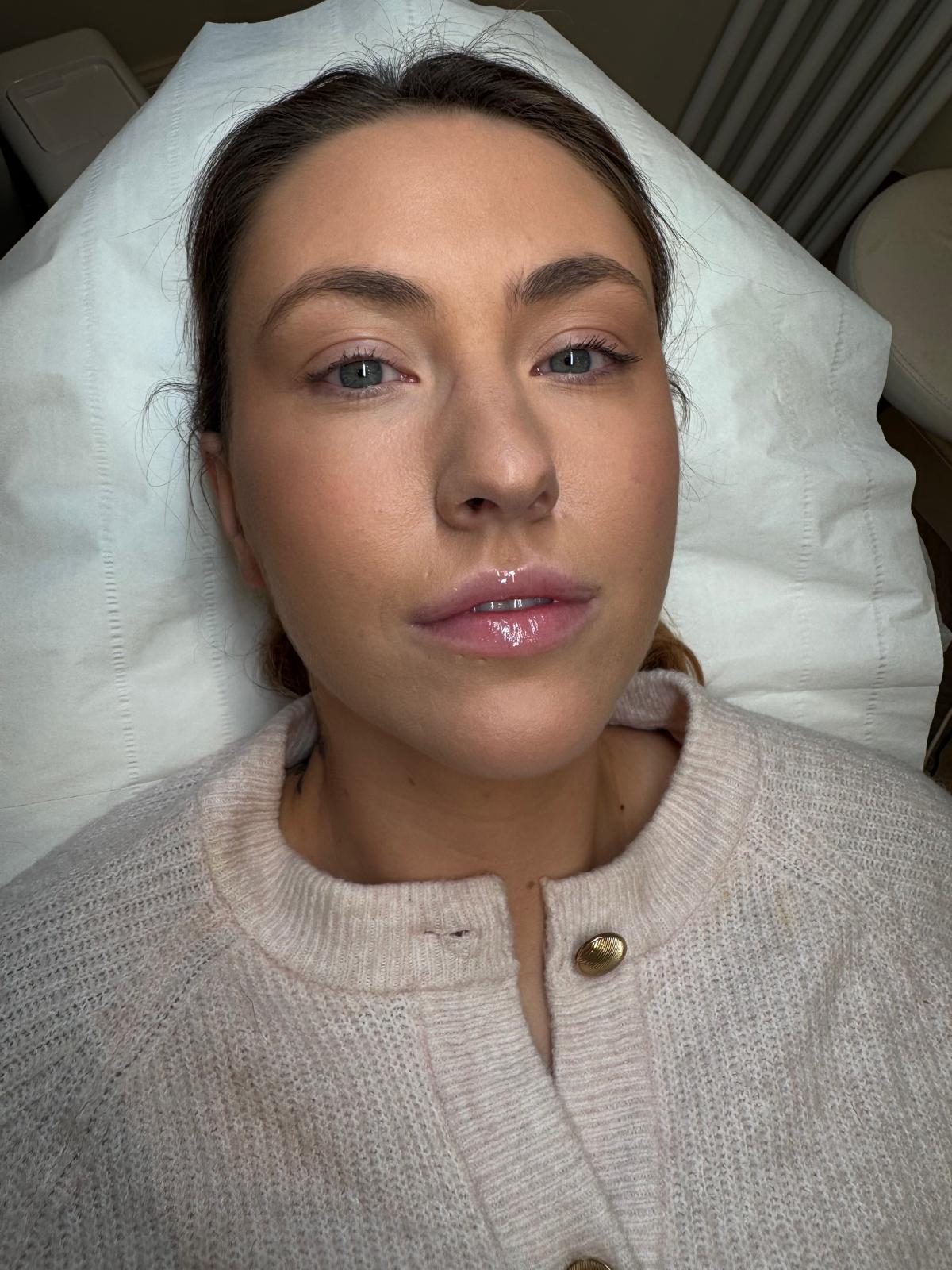 Lip Blush — before